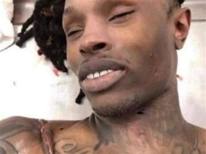 Unraveling the Mystery Behind King Von's Autopsy Pic
